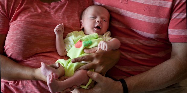 Babies born by caesarean section are more likely to become obese as children, a study says. Photo / AP