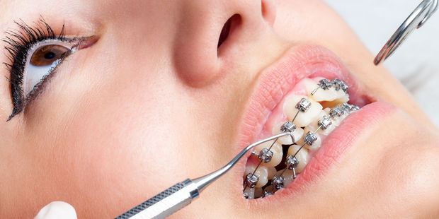 Having a bad bite meant worse balance, they found, particularly when the subjects were tired. Photo / 123RF.com