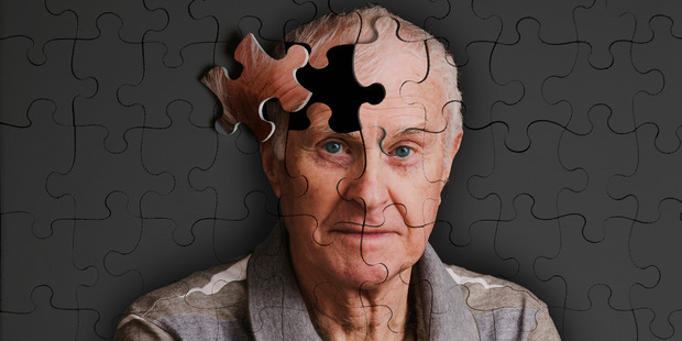 A person who may have had no problems with spelling words in the past may begin to struggle. Photo / Getty