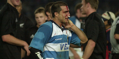 Chris Jack (L) watches wounded Pumas captain Lisandro Arbizu leave the field following the rugby test against the Pumas at the River Plate Stadium. Photo / Getty Images