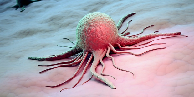 In order to find more effective ways to treat the disease, we needed to find some order in the chaos. Photo / Getty