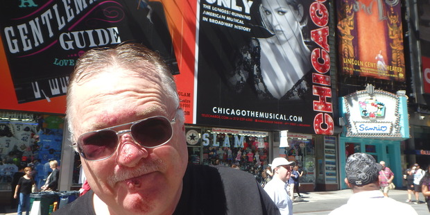Paul Charman says he toured the States "with a face like a racoon" after tripping on stairs in Chicago.