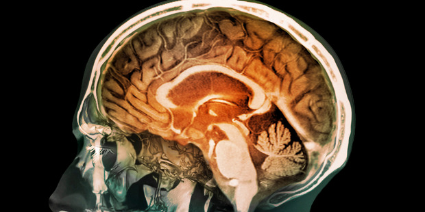 Without the drug, the process occurs as a vital "clean up service" in which enzymes rid the body of unwanted matter. Photo / Getty