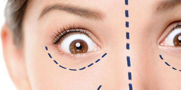 Odd cosmetic surgery becoming more popular. Photo / 123rf