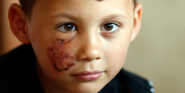 Tyree Walters, 6, was attacked by a dog and had his home burgled. His dead father's PlayStation was taken while he was being treated in hospital - that's all he wants returned. 25 October 2016 Northe