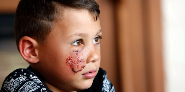 Tyree Walters, 6, was attacked by a dog and had his home burgled. His dead father's PlayStation was taken while he was being treated in hospital - that's all he wants returned. Photo / John Stone