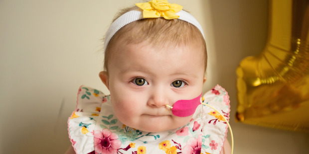 Isabella Dawson was born with a rare form of leukaemia and given survival odds of less than ten per cent. Photo / Emma MacDonald
