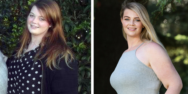 Elora before and after her dramatic weight loss. Photo / Martin Hunter, Caters News