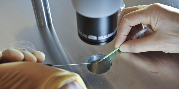 The research could help to prevent miscarriages. Photo / AP