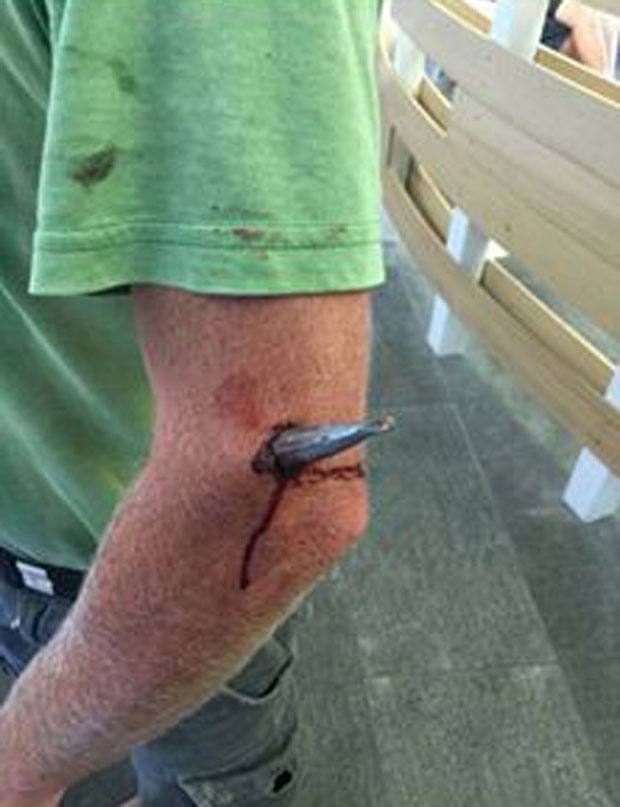 The Auckland man was left with a large sinker protruding from his arm. Photo / Top Catch Whangarei Facebook