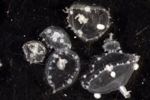 Jellyfish seen under a microscope, thought to be the cause of rashes appearing after swimming at the Mount Beach. Photo / Rod Asher