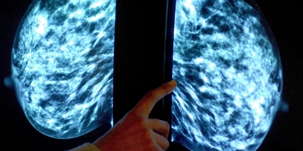 Chemotherapy should be kept to a minimum to avoid unstoppable cancer cells developing, claim scientists.