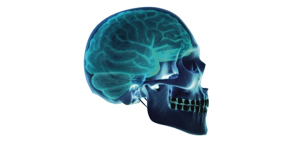 A study has found suicide rates among those who suffered concussions were three times the population norm. Photo / Getty