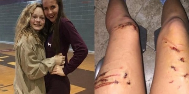 A teenager punched a shark on the nose to survive an attack Photo / Twitter