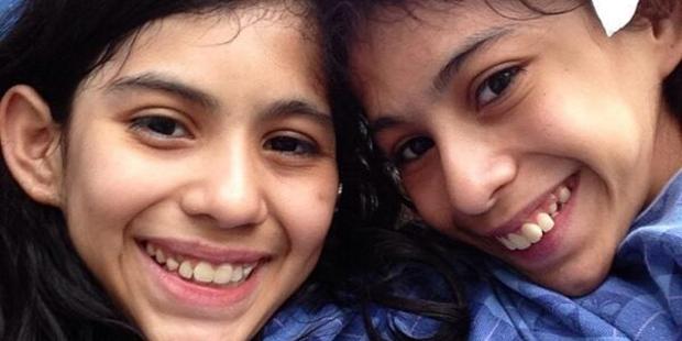 Lupita and Carmen Andrade, 16, were born joined from chest wall to pelvis. Photo / Twitter