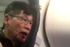 United Airlines reached a confidential settlement with Dr David Dao. Photo / Kaylyn Davis United Airlines reached a confidential settlement with Dr David Dao. Photo / Kaylyn Davis