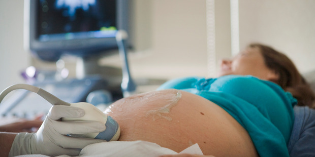 A sonographer and district health board were criticized for their care of a pregnant woman. Photo/Getty Images