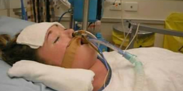 Aimee Squire spent two weeks in a coma followed by three months in hospital and a month in a rehabilitation unit after the crash. Photo / Supplied