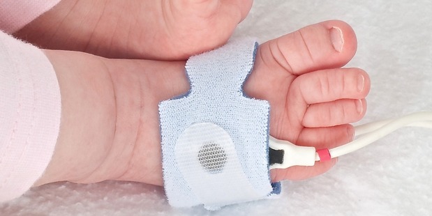 A pulse oximeter can help detect congenital heart defects in newborns by checking the level of oxygen in the blood. Photo / Supplied.