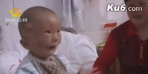In 2010, Huikang underwent two surgical operations at the No. 163 Military Hospital.