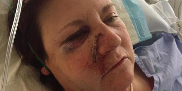 Christine Welch, a driving instructor who was seriously injured when her van collided with a car on State Highway 2 at Apata, west of Tauranga, on 24 September 2016. Photo/supplied