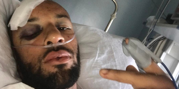 British Olympic sprinters injured after crash in Tenerife