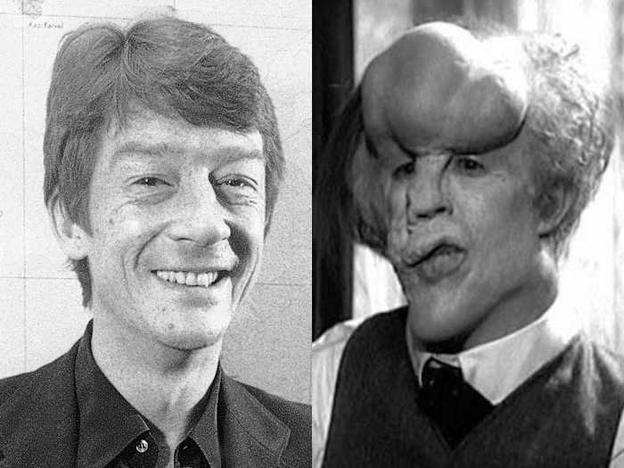 Hurt won acclaim as Joseph Merrick in The Elephant Man. Photo / Supplied