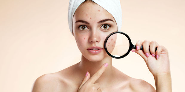 Between 40-54 per cent of men and women older than 25 years suffer from acne. Photo / 123RF