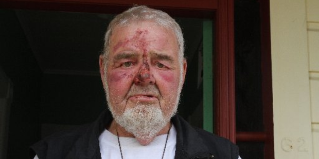 Shannon man Corny Andrews was attacked at his farm in Shannon. Photo / Horowhenua Guardian