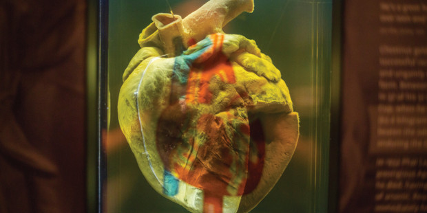 Phar Lap's heart.
